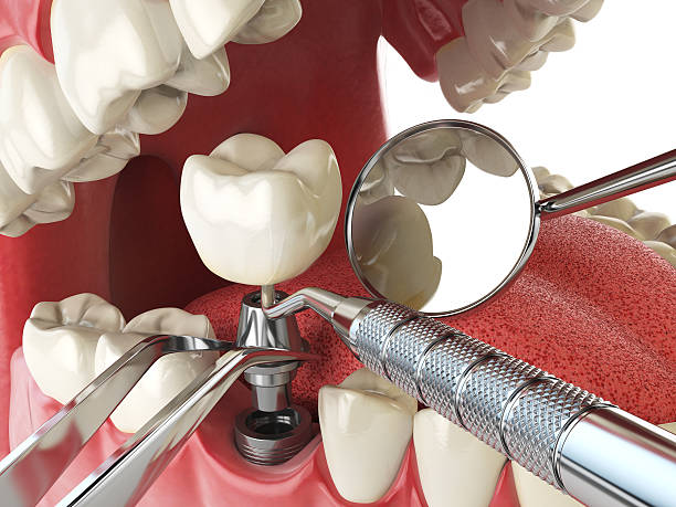 Best Broken Tooth Emergency  in Dunkirk, NY